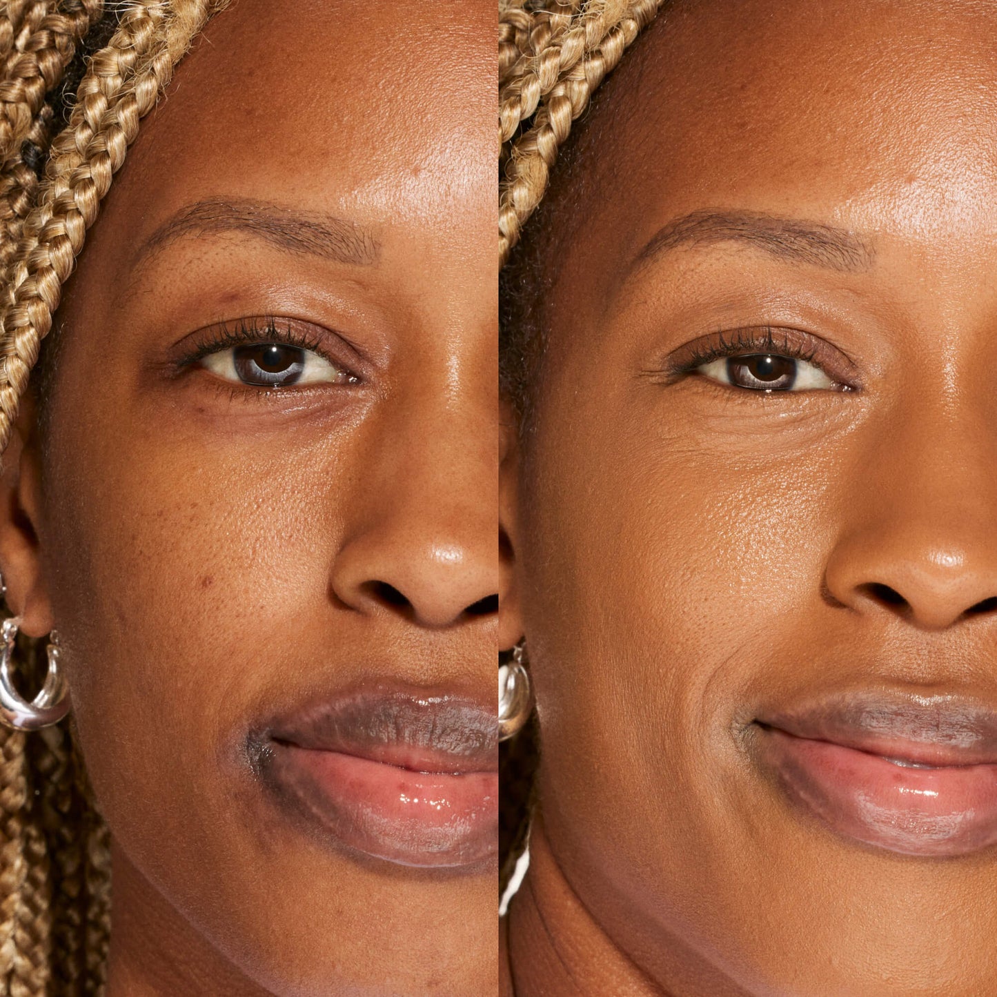 16.0 SB [A person's face before and after using Tower 28 Beauty's Swipe Serum Concealer in shade 16.0 SB to cover up dark circles, blemishes, and discoloration]