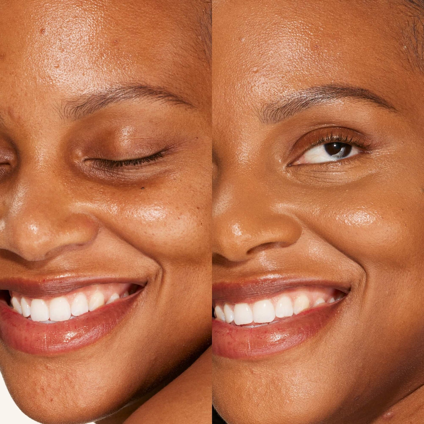 16.0 SB [A person's face before and after using Tower 28 Beauty's Swipe Serum Concealer in shade 16.0 SB to cover up dark circles, blemishes, and discoloration]