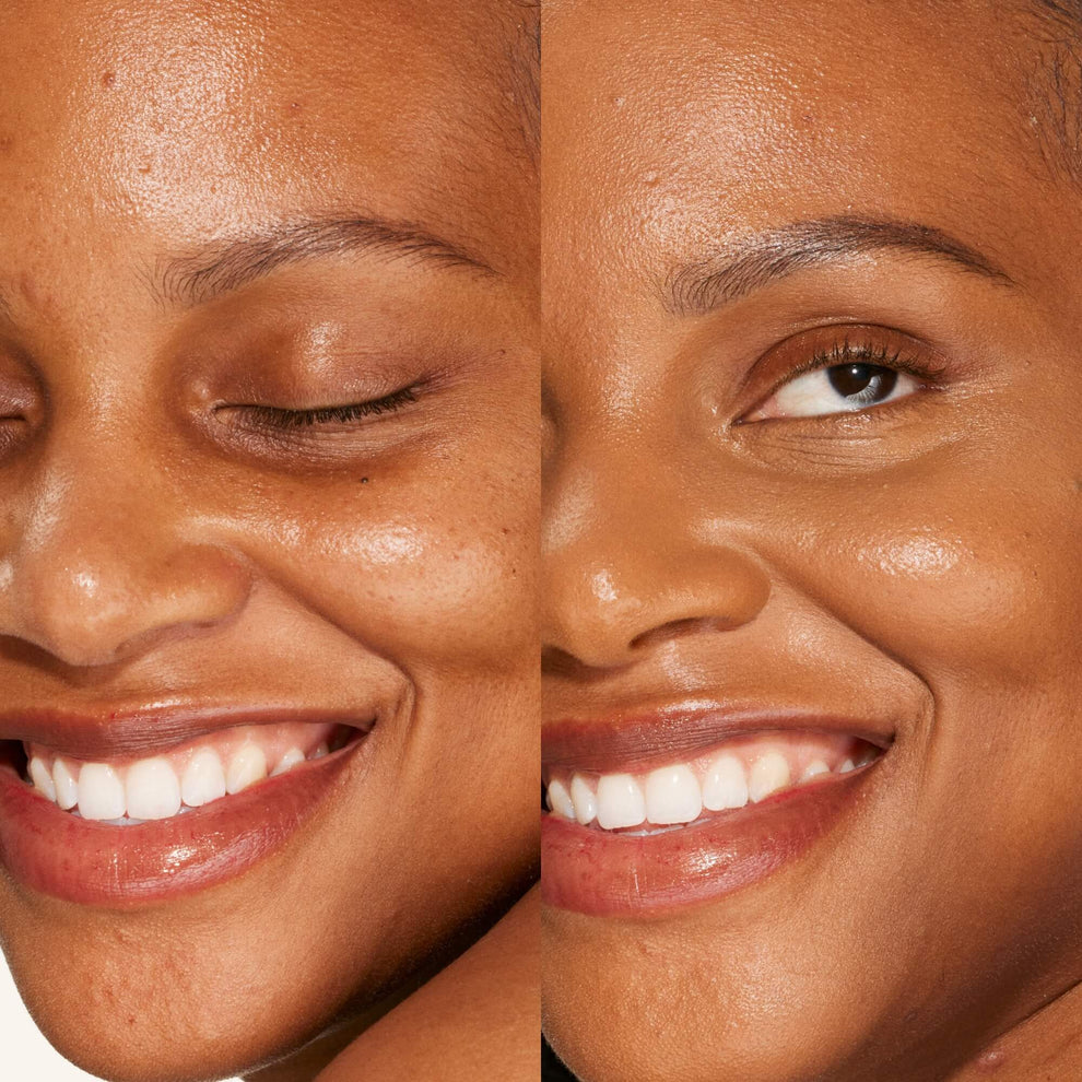 A person's face before and after using Tower 28 Beauty's Swipe Serum Concealer in shade 16.0 SB to cover up dark circles, blemishes, and discoloration