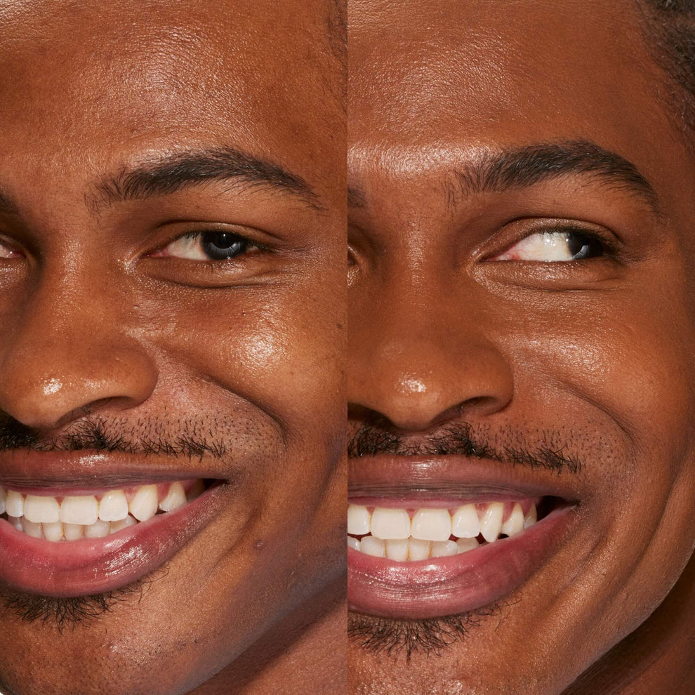 A person's face before and after using Tower 28 Beauty's Swipe Serum Concealer in shade 17.0 SD to cover up dark circles, blemishes, and discoloration