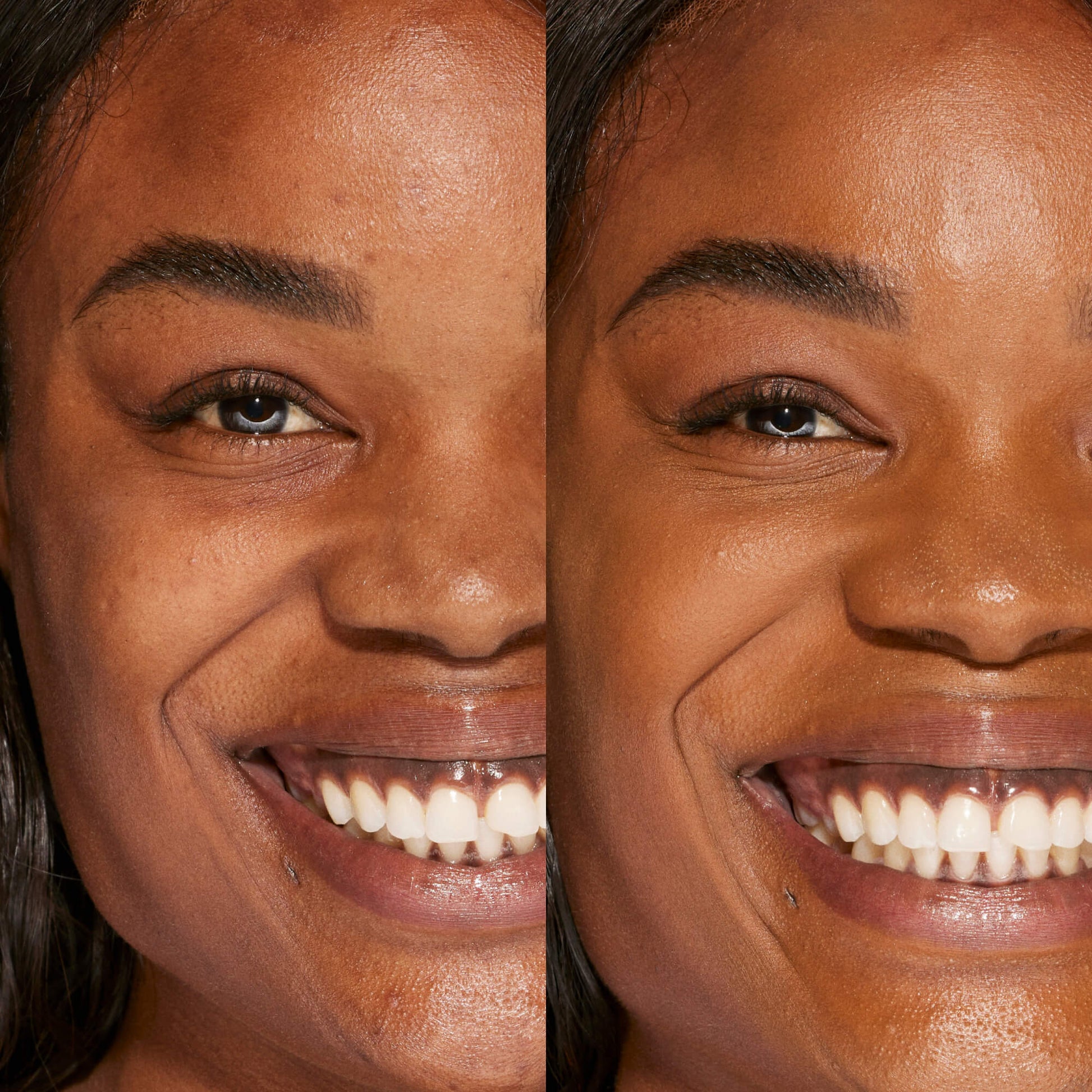 A person's face before and after using Tower 28 Beauty's Swipe Serum Concealer in shade 18.0 SGV to cover up dark circles, blemishes, and discoloration