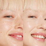 A person’s face before and after using Tower 28 Beauty's Swipe Serum Concealer in shade 2.0 BU to reduce redness, blur freckles, and create a smooth, even finish. [2.0 BU]