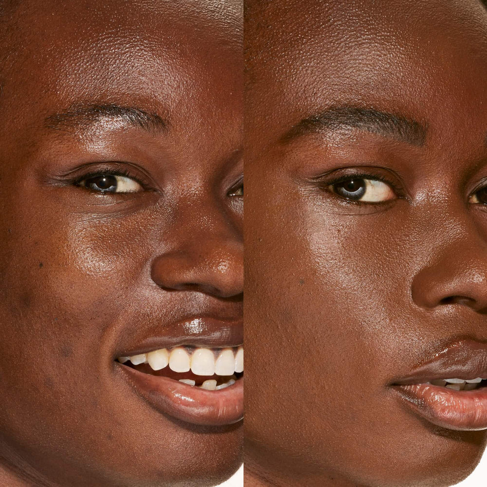 A person's face before and after using Tower 28 Beauty's Swipe Serum Concealer in shade 20.0 WLA to cover up dark circles, blemishes, and discoloration