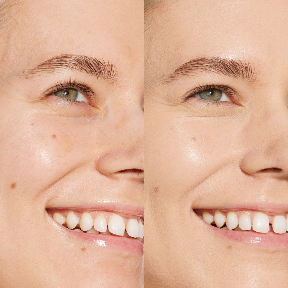 A person's face before and after using Tower 28 Beauty's Swipe Serum Concealer in shade 3.0 CC to cover up dark circles, blemishes, and discoloration