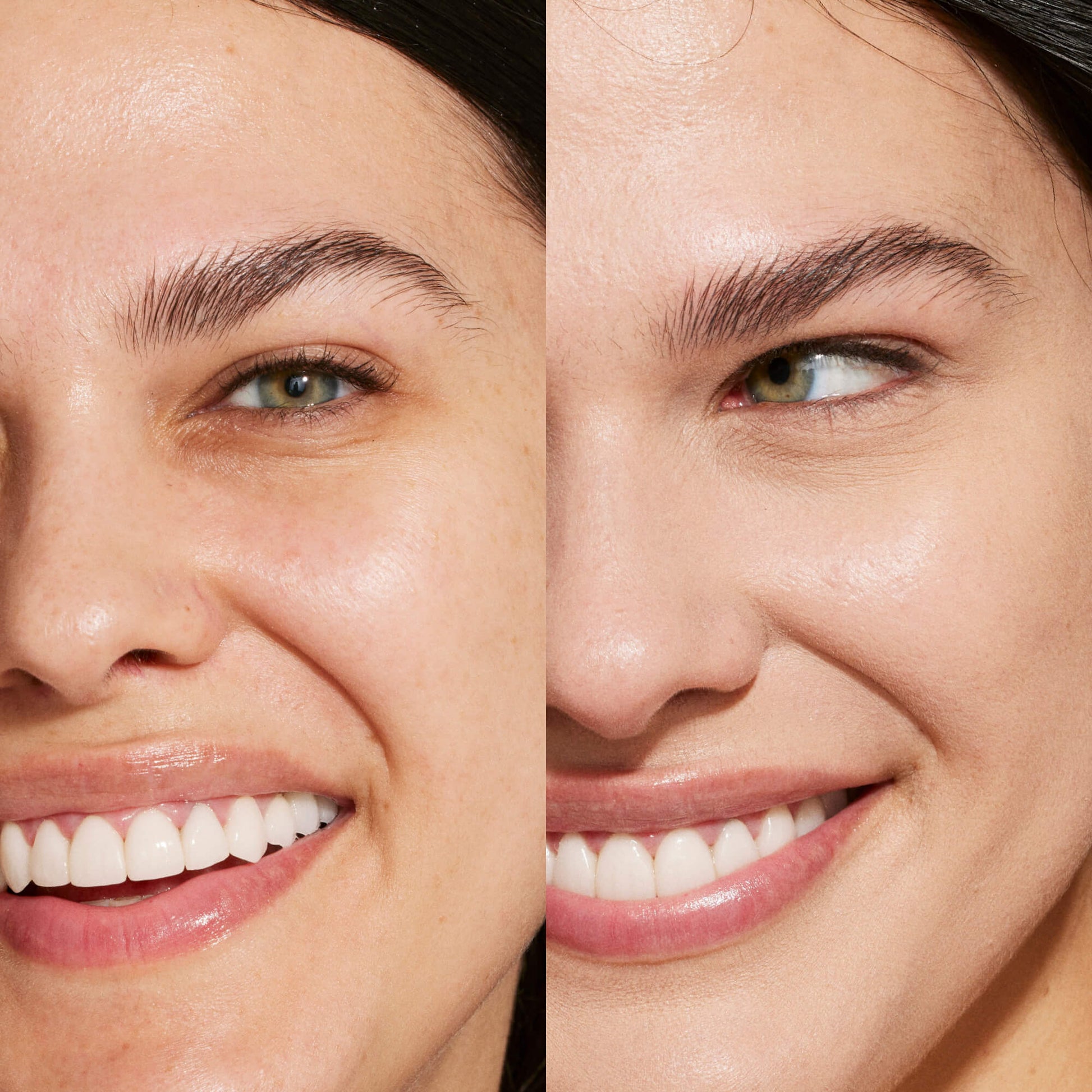 A person's face before and after using Tower 28 Beauty's Swipe Serum Concealer in shade 5.0 EP to cover up dark circles, blemishes, and discoloration
