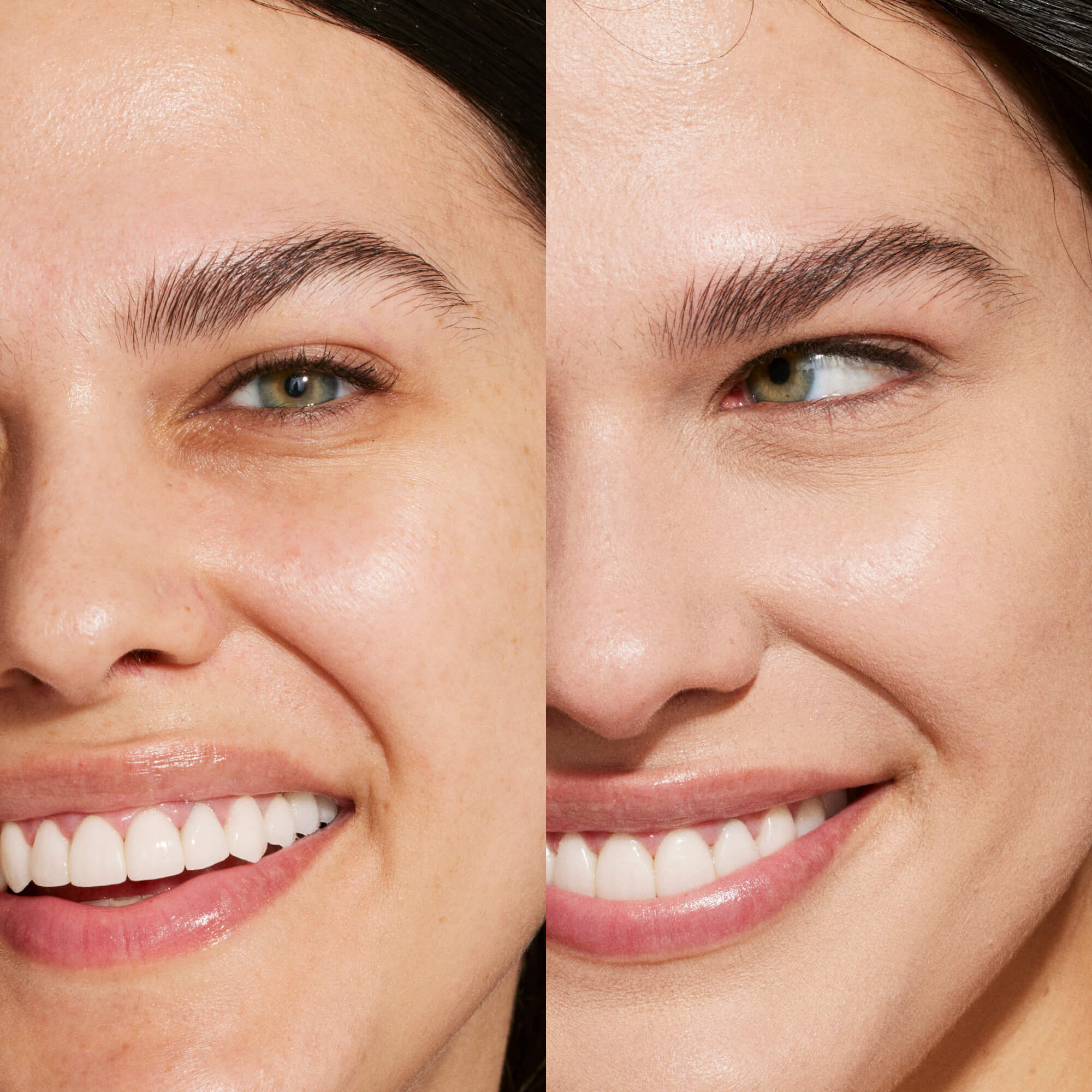 A person’s face before and after using Tower 28 Beauty's Swipe Serum Concealer in shade 5.0 EP to visibly brighten under eyes, smooth skin texture, and even out skin tone. [5.0 EP]