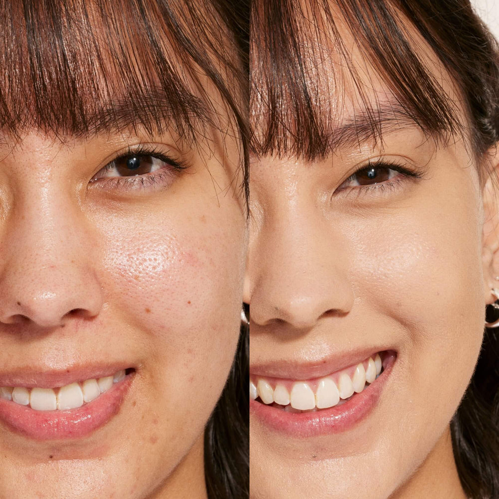 A person's face before and after using Tower 28 Beauty's Swipe Serum Concealer in shade 5.0 EP to cover up dark circles, blemishes, and discoloration