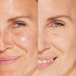 A person’s face before and after using Tower 28 Beauty's Swipe Serum Concealer in shade 6.0 IE to neutralize redness, brighten dullness, and smooth skin texture. [6.0 IE]