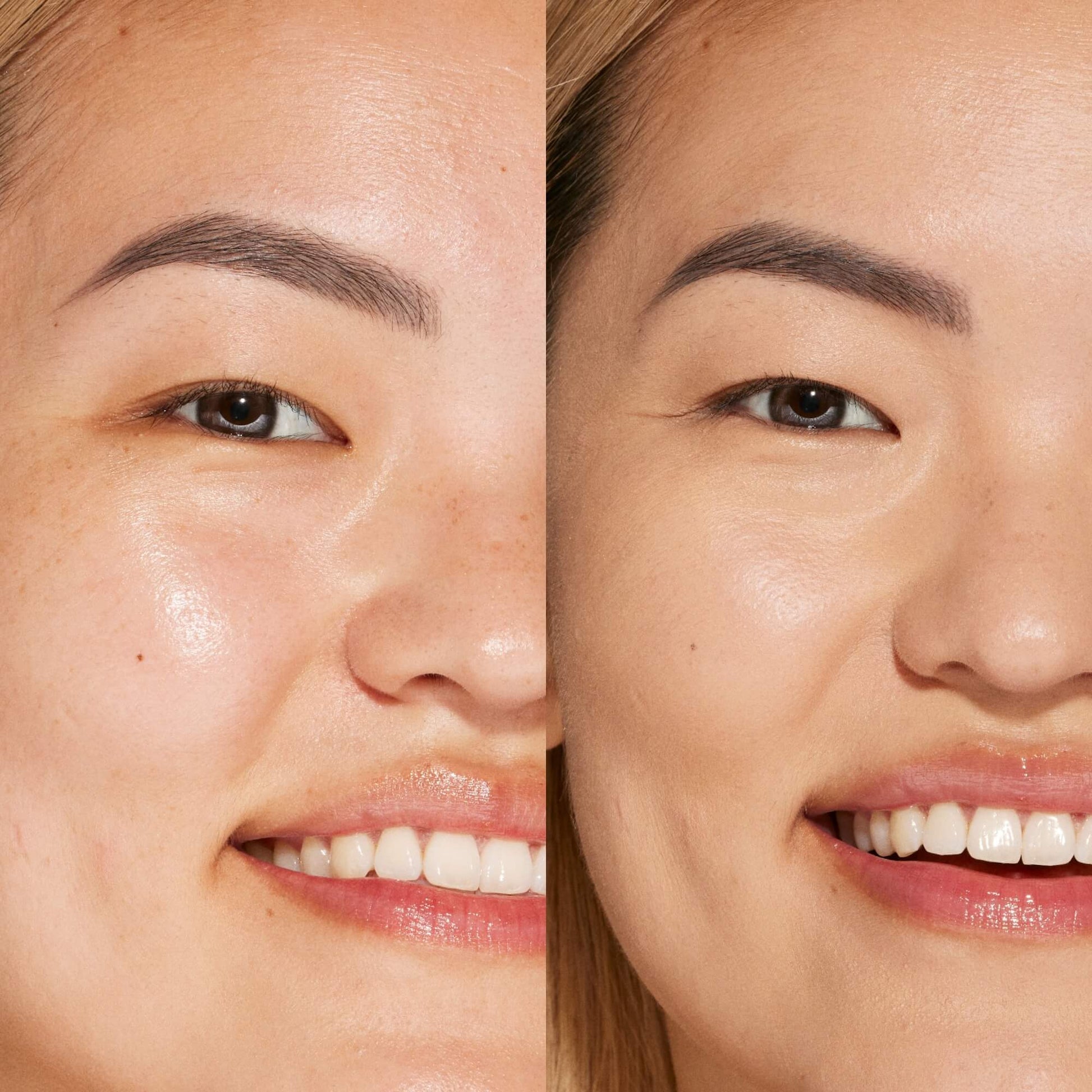 A person's face before and after using Tower 28 Beauty's Swipe Serum Concealer in shade 6.0 IE to cover up dark circles, blemishes, and discoloration