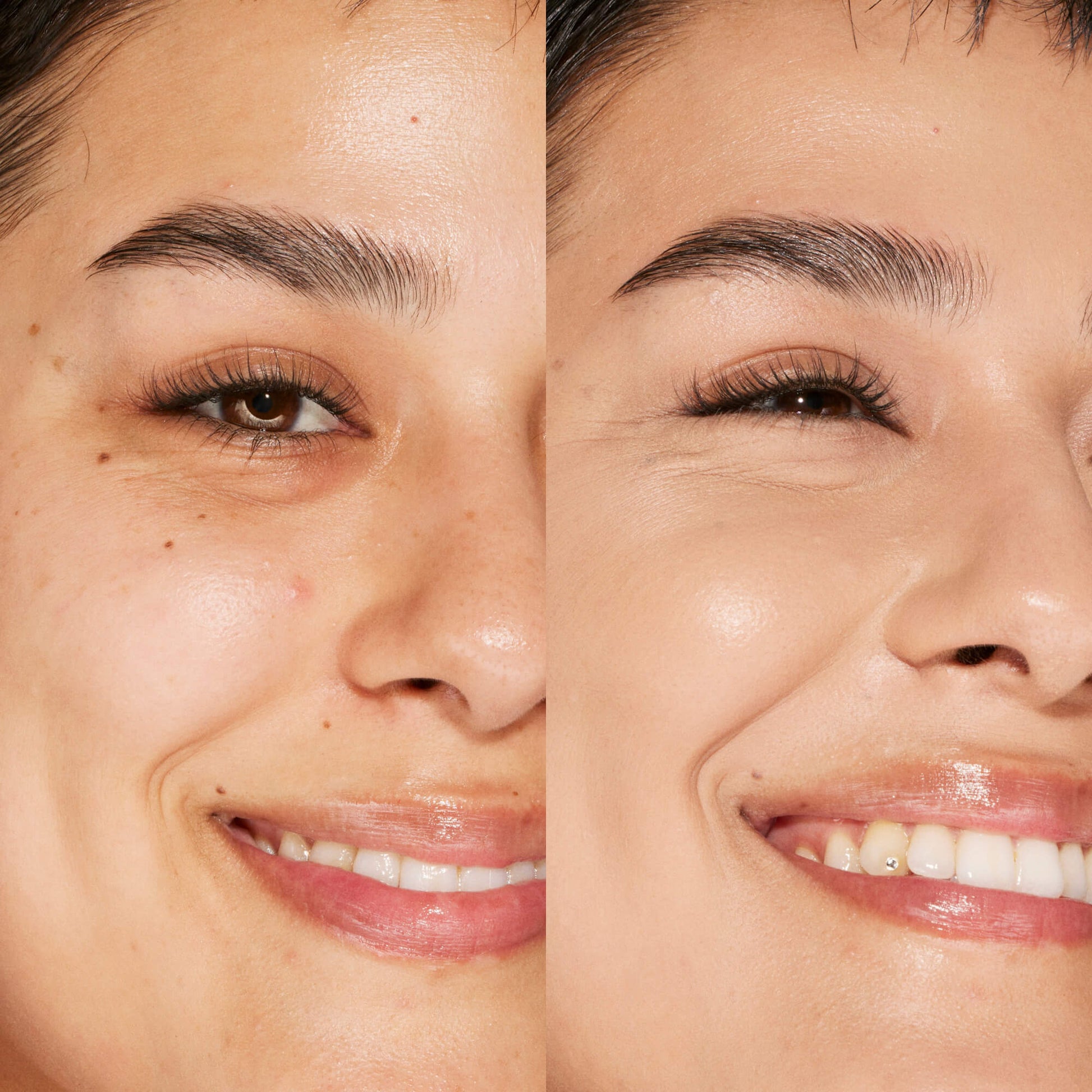 A person's face before and after using Tower 28 Beauty's Swipe Serum Concealer in shade 7.0 KTOWN to cover up dark circles, blemishes, and discoloration