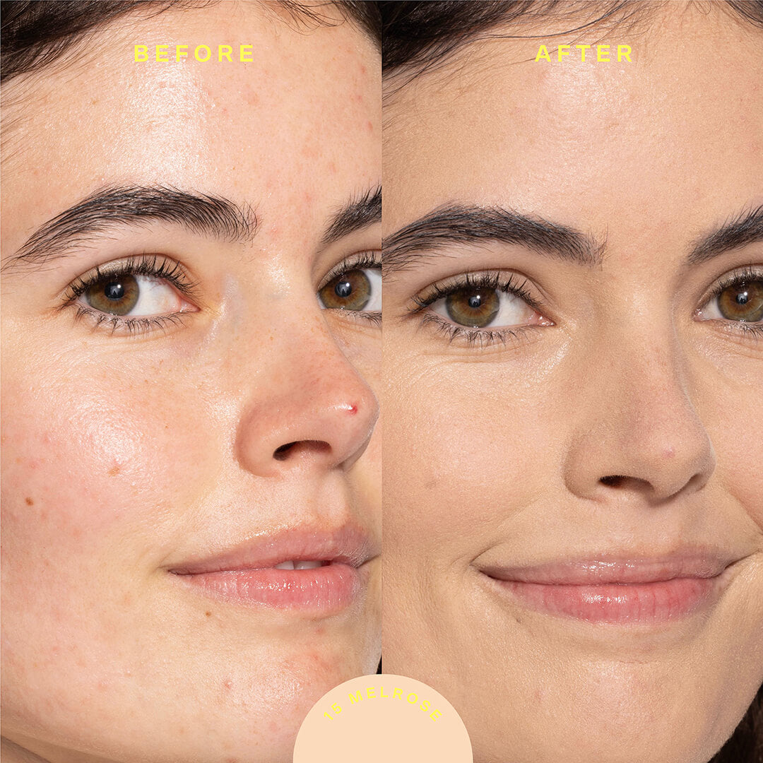 A model before (left image) and after (right image) applyingTower 28 Beauty SunnyDays™ Tinted SPF 30 in the shade 15 Melrose