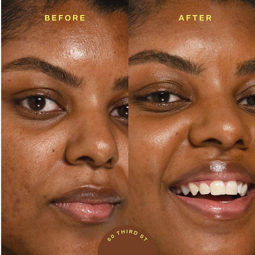 A model before (left image) and after (right image) applying Tower 28 Beauty SunnyDays™ Tinted SPF 30 in the shade 60 Third St